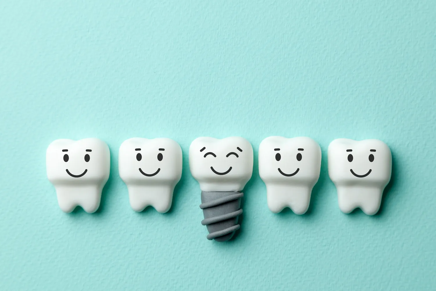 Ranking implantów zębowych - o tym warto wiedzieć