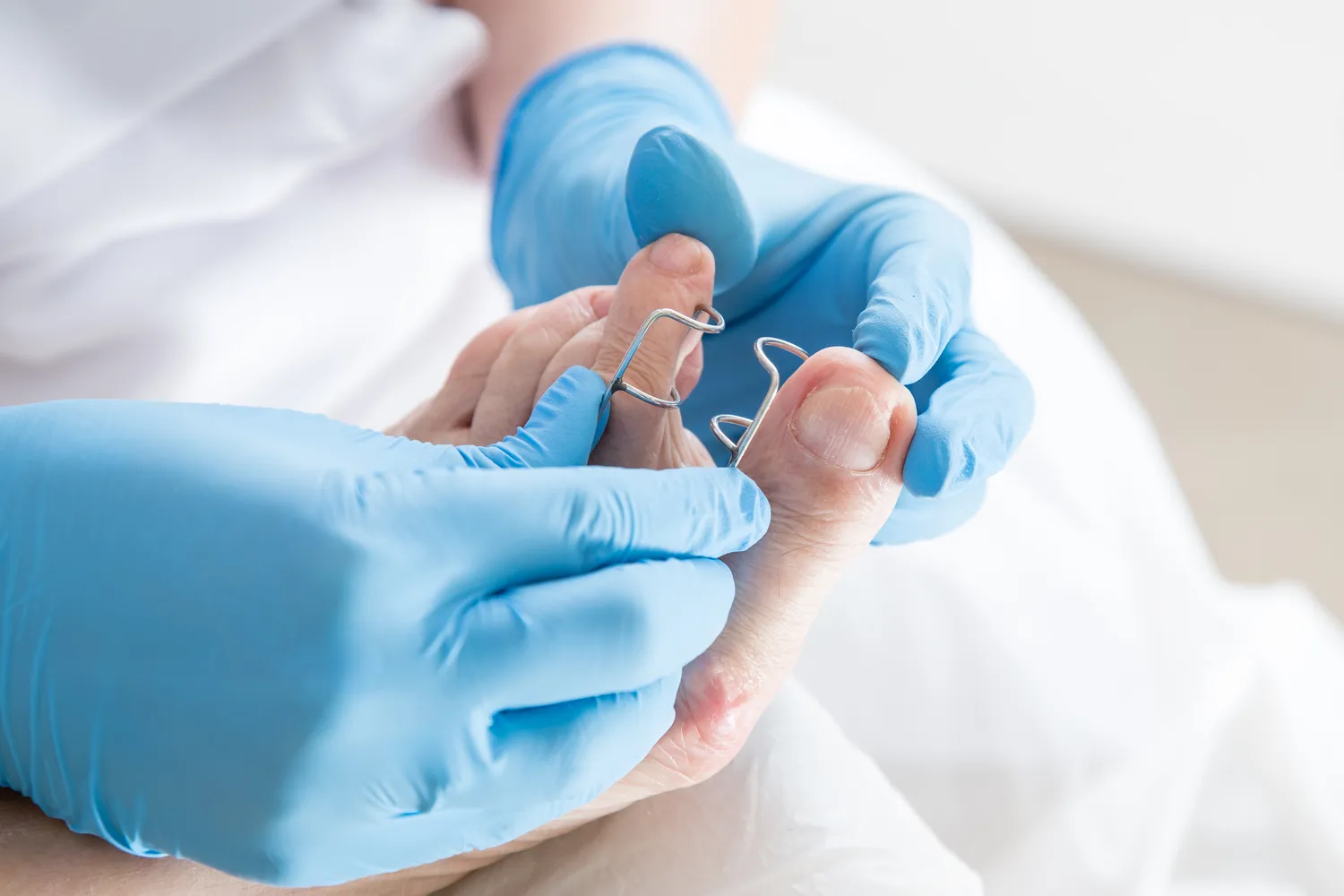 Pedicure leczniczy - czym jest i co warto wiedzieć na jego temat?